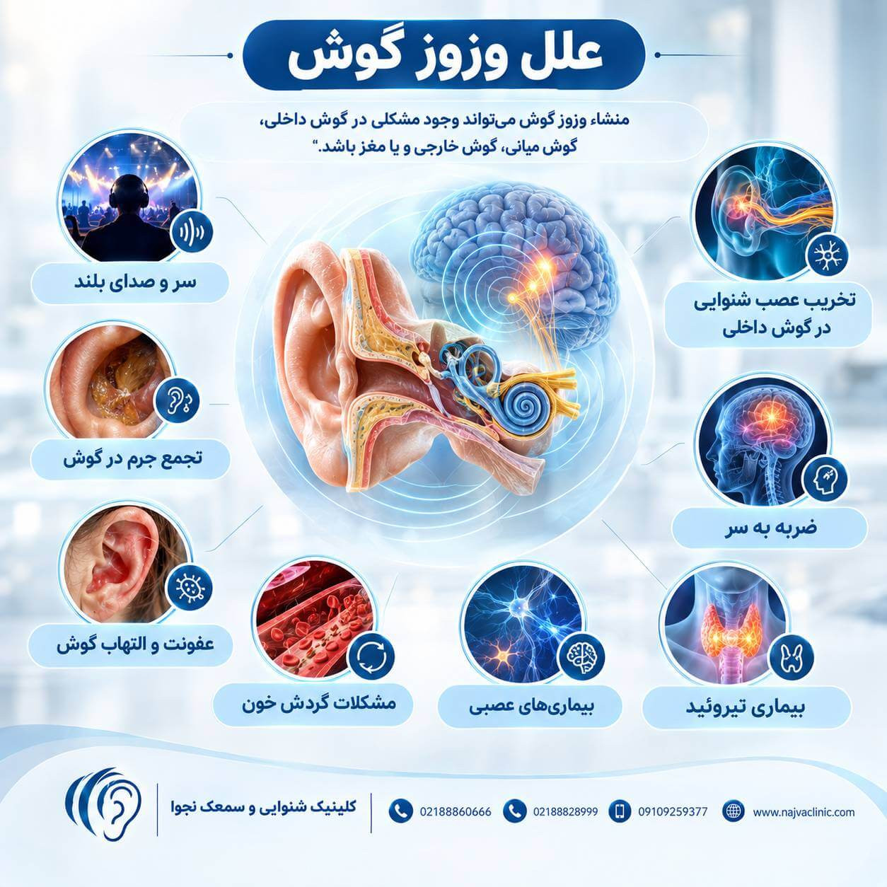 بررسی علل وزوز گوش شامل صدای بلند، تجمع جرم گوش، عفونت، آسیب عصب شنوایی و مشکلات گردش خون